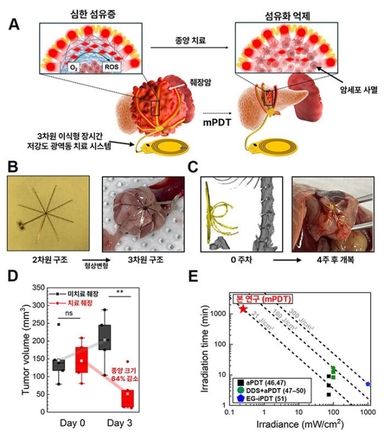 문어다리 처럼 착! 췌장 감싸서 암 막는다