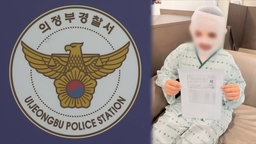 태국인 아내에 끓는 물 부은 남편…경찰서 "실수"