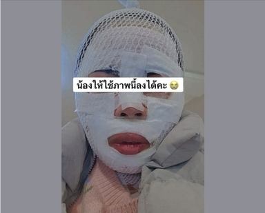 태국인 아내에 끓는물 부은 40대…경찰 조사받자 "실수" 말바꿔