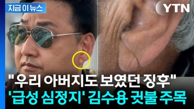 김수용, 쓰러지기 전 귓불에..."전조 증상 아니냐" 온라인서 주목 [지금이뉴스]