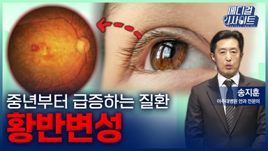 [메디컬 인사이트 114회] 중년부터 급증하는 '황반변성의 증상과 치료법'