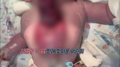 몸 바깥에서 심장 뛰던 '서린이', 국내 첫 수술 성공..."절망 속 희망 준 의료진께 감사" [앵커리포트]