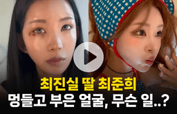 최진실 딸 최준희의 멍들고 부은 얼굴, 무슨 일이길래..?