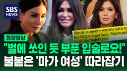 [현장영상] "볼 더 빵빵하게!" "입술은 벌이 쏜 것처럼!" 워싱턴서 요청 쇄도한 '마가 성형' 뭐길래?